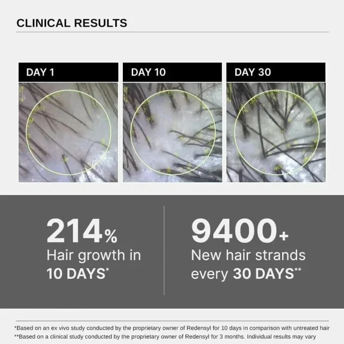 Bare Anatamoy Advanced Hair Growth Serum 3% Redensyl, Biotin, Rosemary & Rice Extract 30ml - Image 4