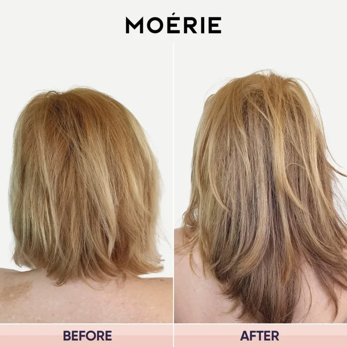 Moerie Ultimate Hair Boost Spray Biotin & Minerals 150ml - Image 6