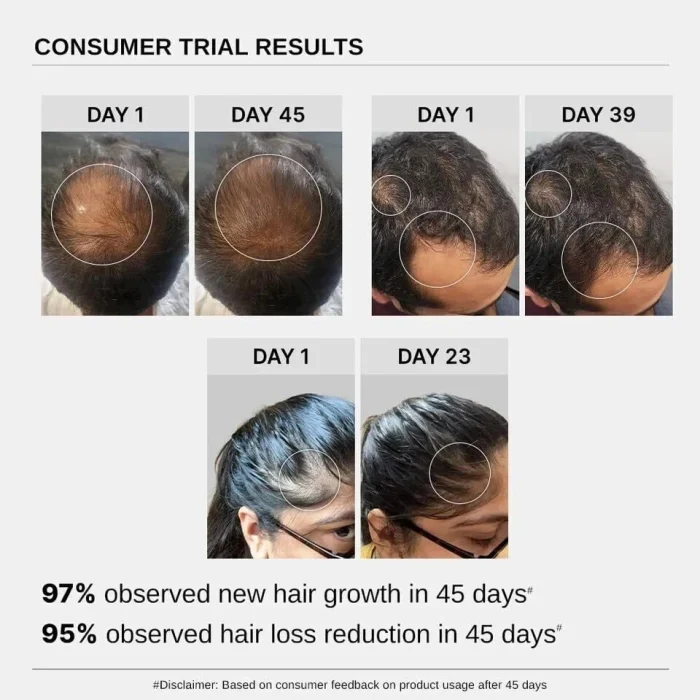Bare Anatamoy Advanced Hair Growth Serum 3% Redensyl, Biotin, Rosemary & Rice Extract 30ml - Image 6